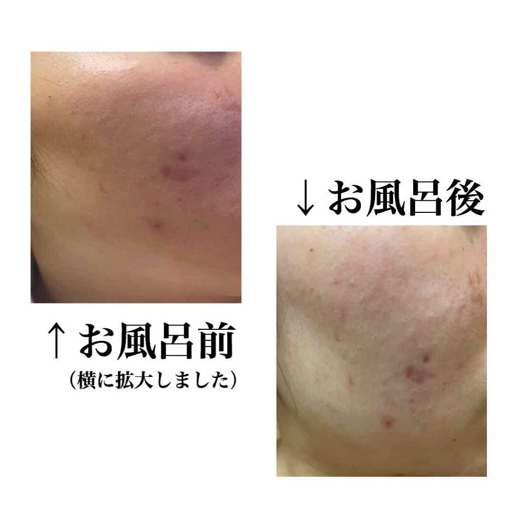 敏感肌用薬用美白美容液/無印良品/美容液を使ったクチコミ（2枚目）