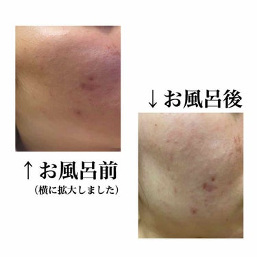 敏感肌用薬用美白美容液/無印良品/美容液を使ったクチコミ（2枚目）