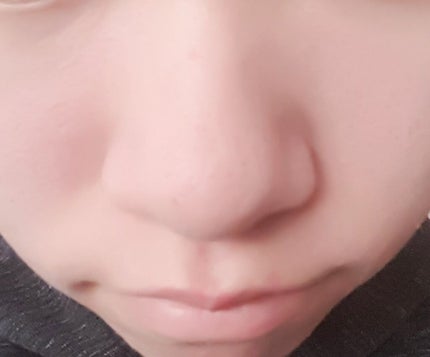 ベビーピンク 立体感クリームのクチコミ「新感覚なクリームタイプのシェーディング!【after写真あり】
ベビーピンク @bison_.....」(3枚目)