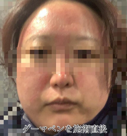 ã䜿ã£ãã¯ãã³ãïŒ2æç®ïŒ