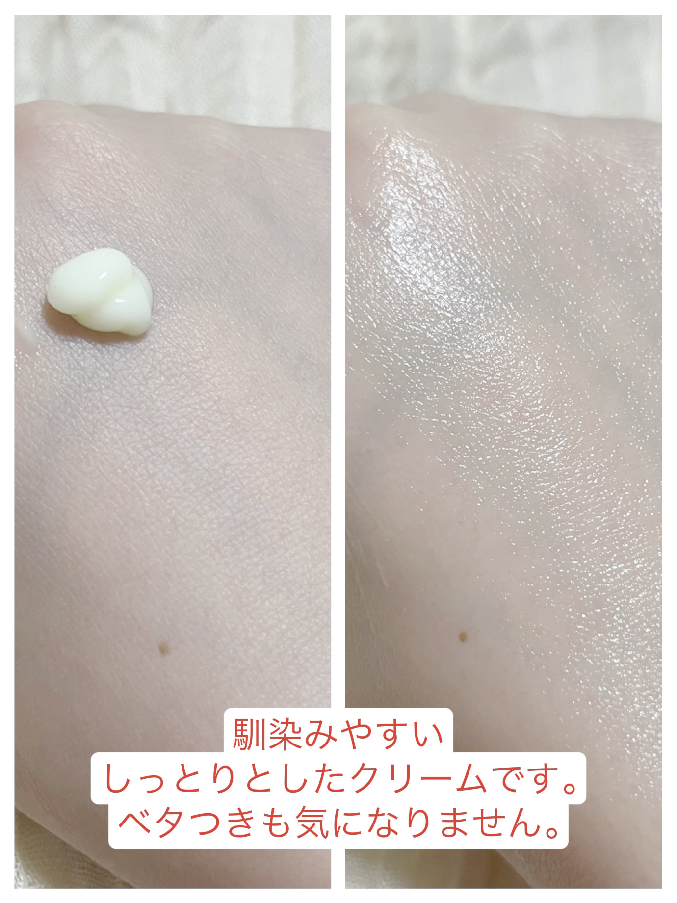 ヴィーガンリポソームレチノールセラム/SKIN&LAB/美容液を使ったクチコミ（2枚目）