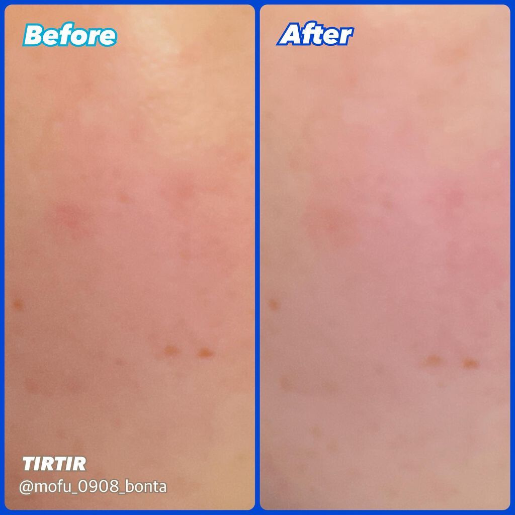 TIRTIR(ティルティル)  ブロッコリオリジンエッセンスのクチコミ「★⌒*＋*⌒★★⌒*＋*⌒★★⌒*＋*⌒★★⌒*＋*⌒★

愛用中❣️Qoo10購入品❣️

.....」（3枚目）