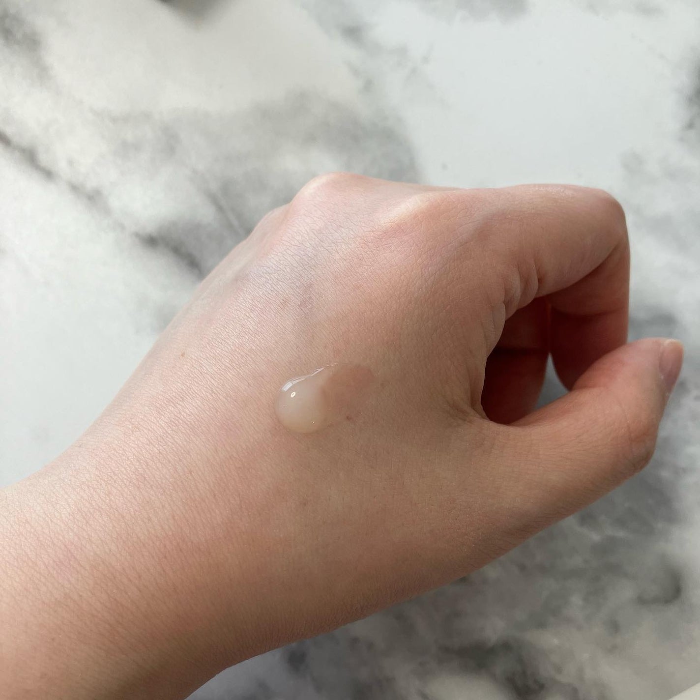 ニキビあとケアジェル/アットノン/その他スキンケアを使ったクチコミ(3枚目)