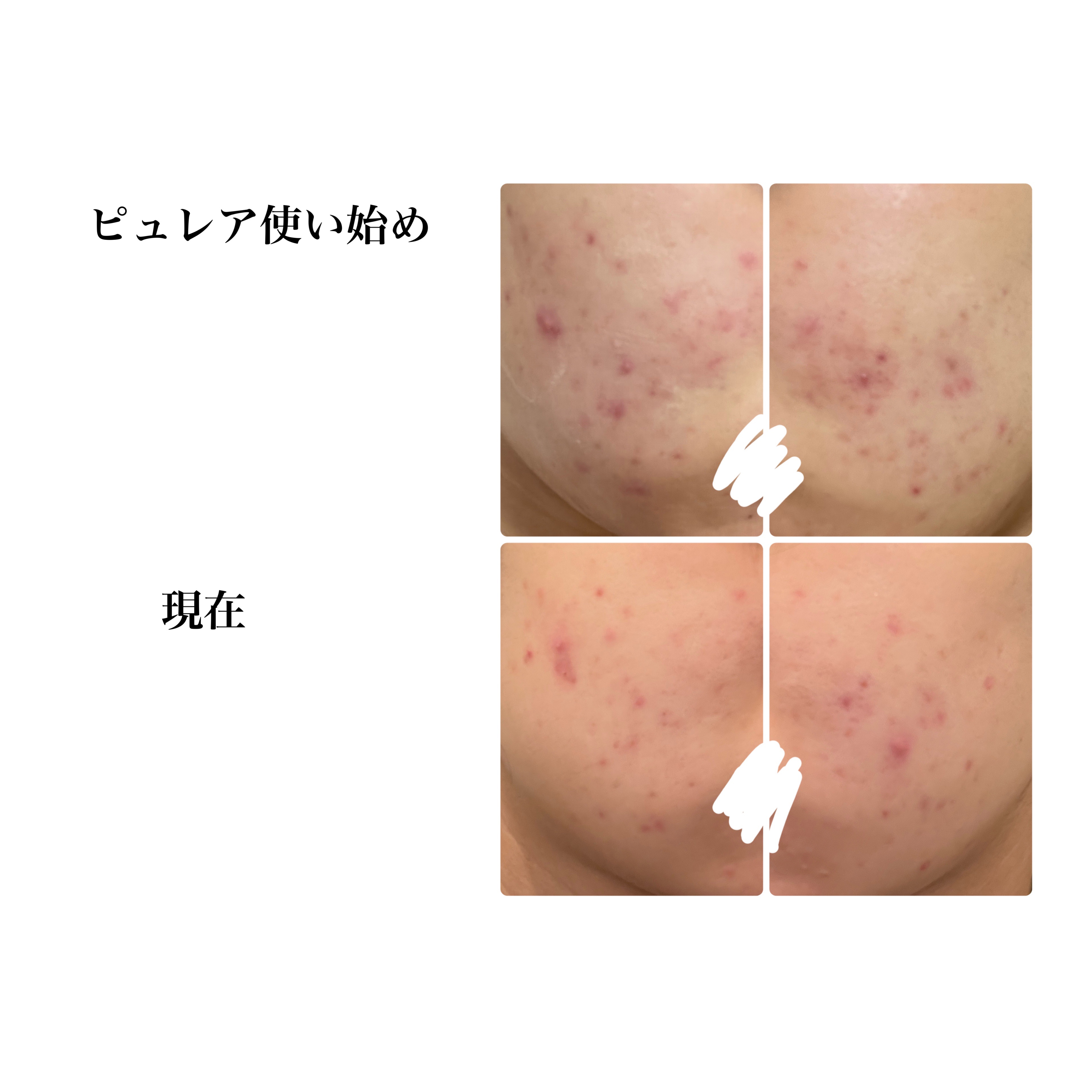 クリアエッセンスマスク/ピュレア/シートマスク・パックを使ったクチコミ（2枚目）