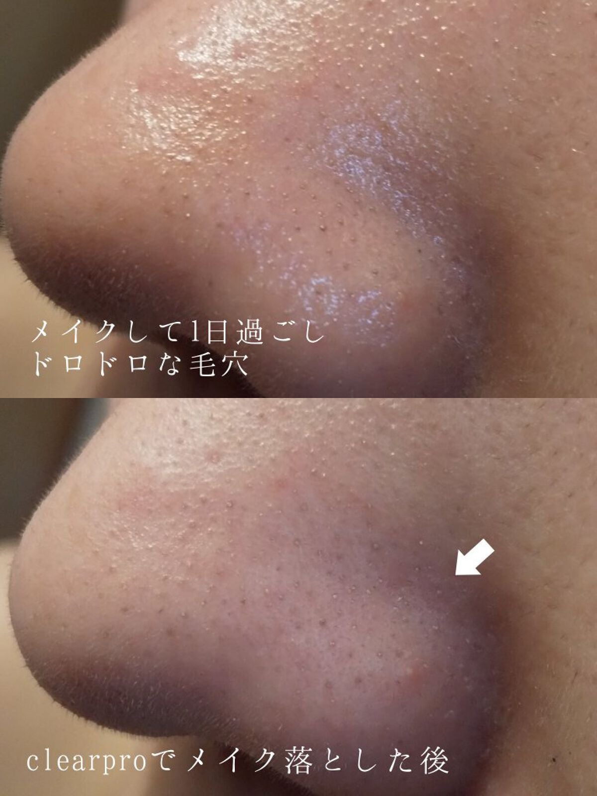 ソフティモ クリアプロ クレンジングバーム CICA ブラック/ソフティモ/クレンジングバームを使ったクチコミ(2枚目)