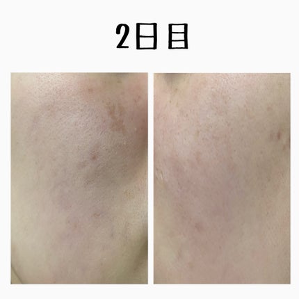 を使ったクチコミ(3枚目)