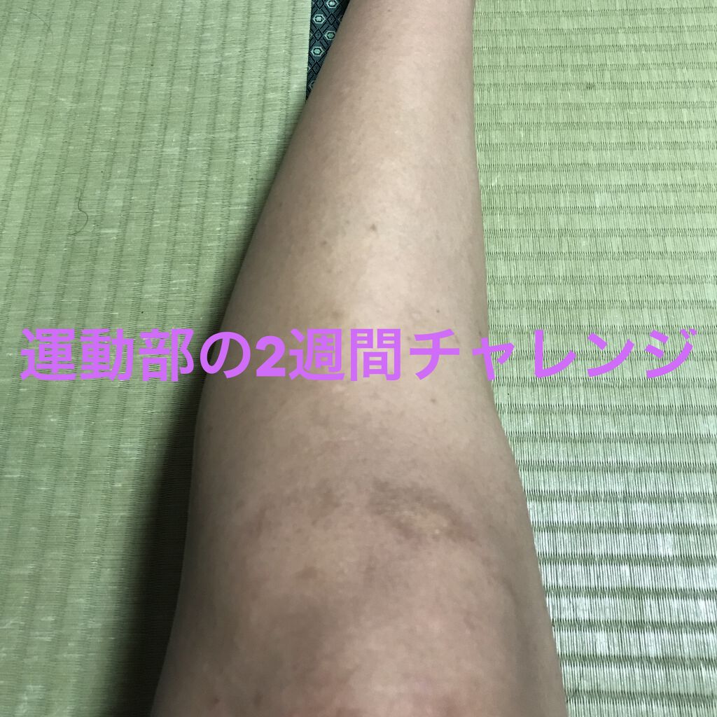 寝ながらメディキュット ロング/メディキュット/着圧ソックス・レギンスを使ったクチコミ（1枚目）