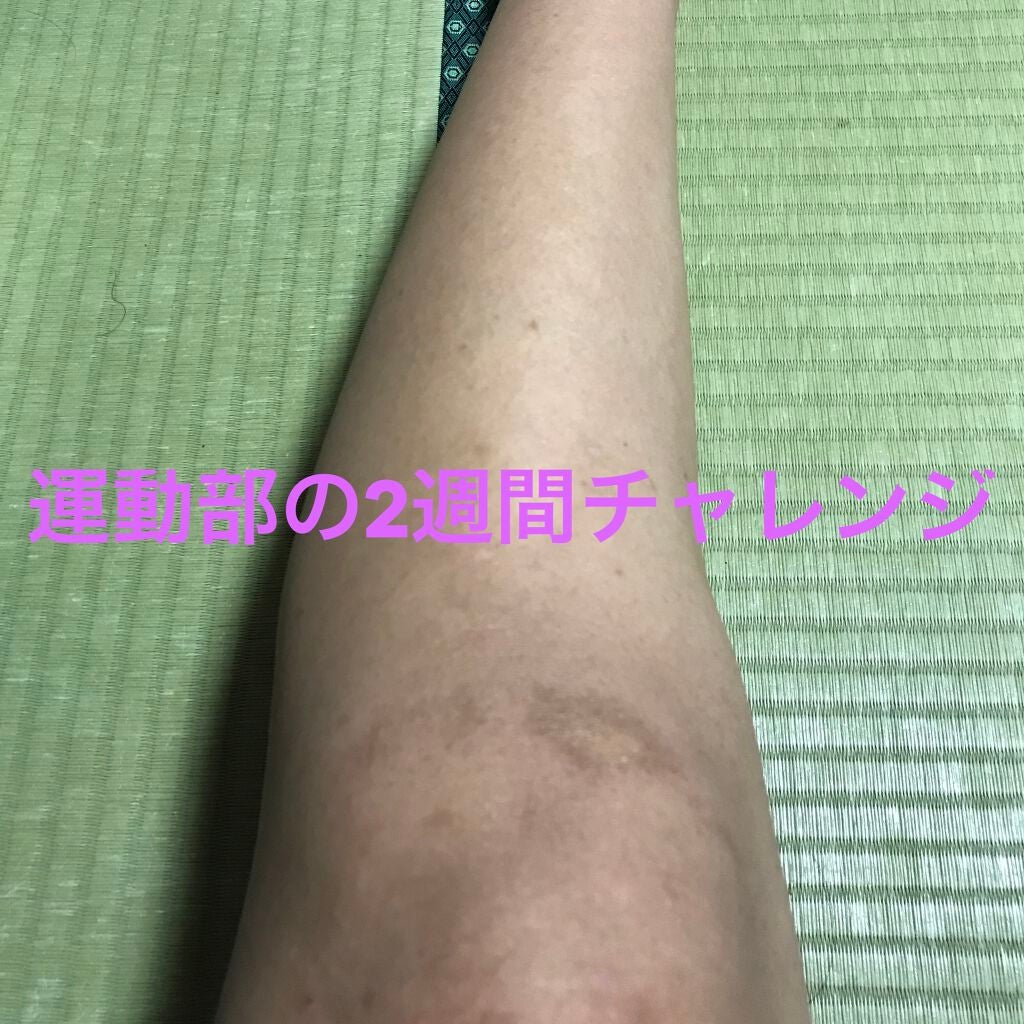 寝ながらメディキュット ロング/メディキュット/着圧ソックス・レギンスを使ったクチコミ(1枚目)