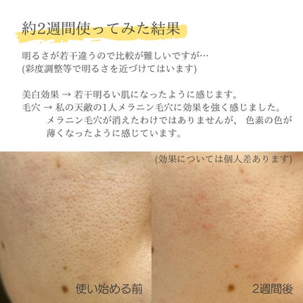 グリーンタンジェリンビタC27ダークスポットケアアンプル/goodal/美容液を使ったクチコミ(6枚目)