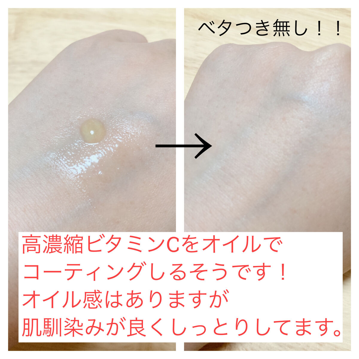 RXザ・ビタミンC23セラム/COSRX/美容液を使ったクチコミ（3枚目）