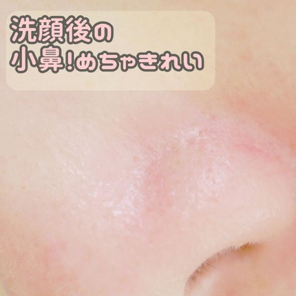 リフレアール トライアルセット/LFREAL/化粧水を使ったクチコミ(2枚目)