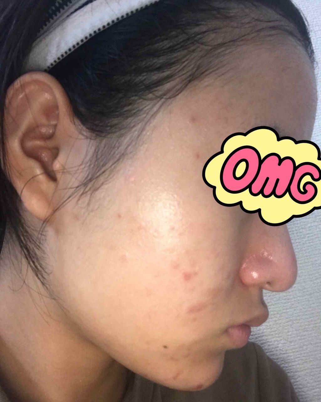 DHC ビタミンＣハードカプセル/DHC/美容サプリメントを使ったクチコミ（3枚目）