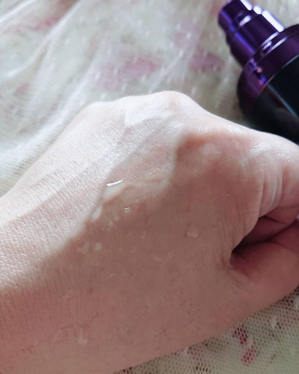 モイスチャーローション/shimaboshi/化粧水を使ったクチコミ(3枚目)