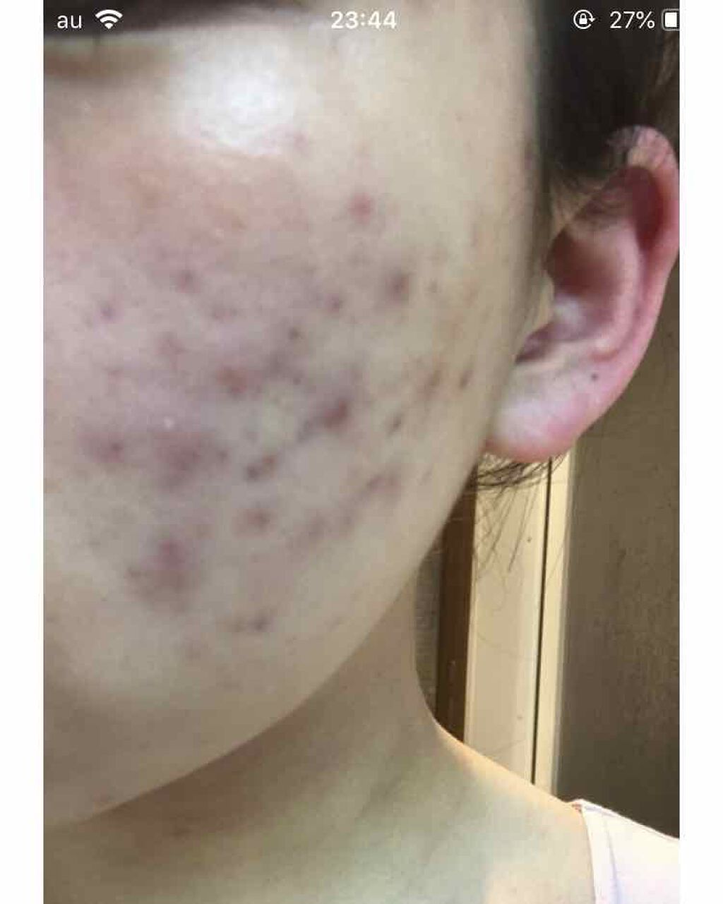 𥺠on LIPS ã#ãããè·¡ããã1æã§ãã..ãïŒ3æç®ïŒ