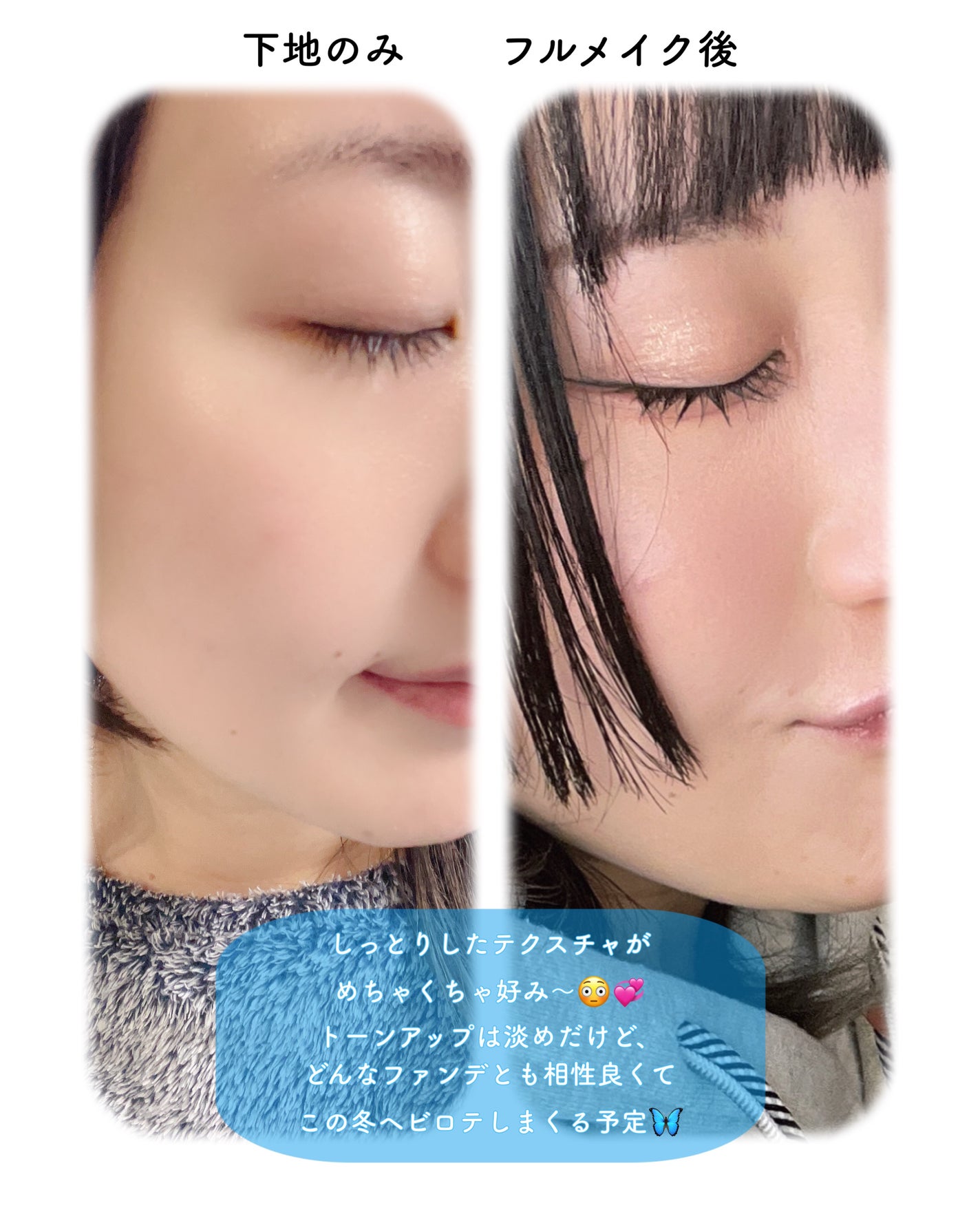 ブラックスネイルレチノールセラム/Dr.G/美容液を使ったクチコミ(4枚目)