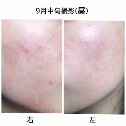 ハトムギ化粧水(ナチュリエ スキンコンディショナー R )/ナチュリエ/化粧水を使ったクチコミ(3枚目)