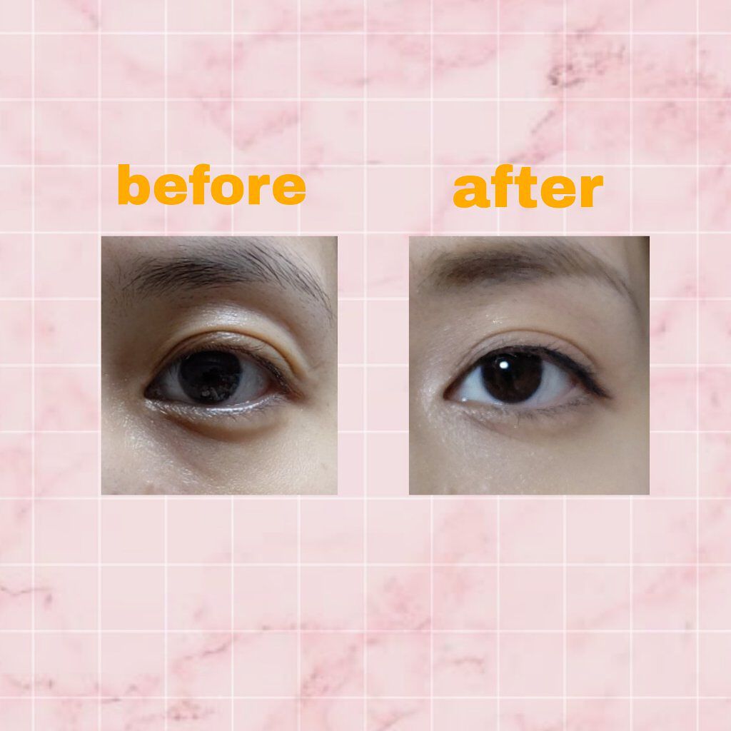 トーンパーフェクティング パレット/DECORTÉ/パレットコンシーラーを使ったクチコミ（1枚目）