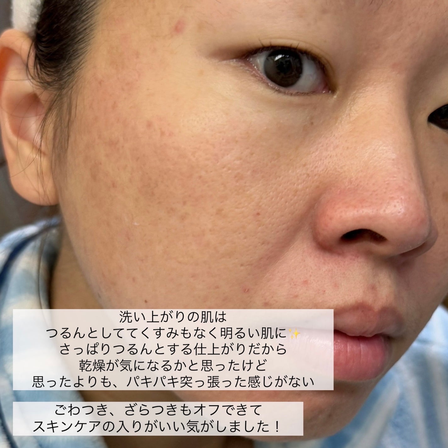 エッセンス ソープ/雪肌精/洗顔石鹸を使ったクチコミ(6枚目)