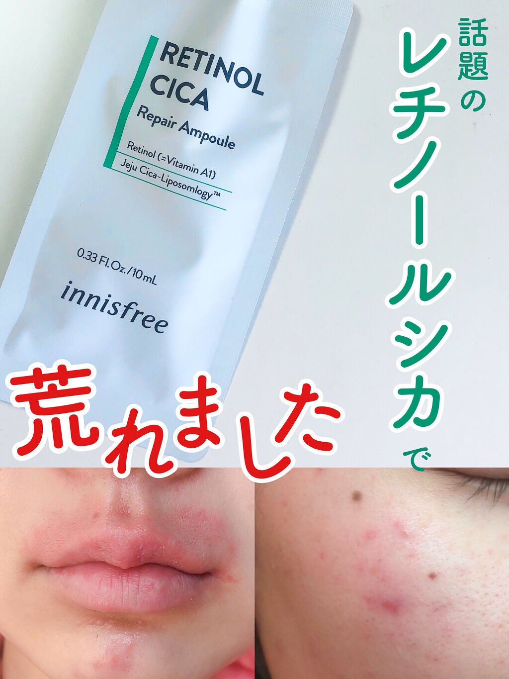 レチノール シカ リペア セラム/innisfree/美容液を使ったクチコミ(1枚目)