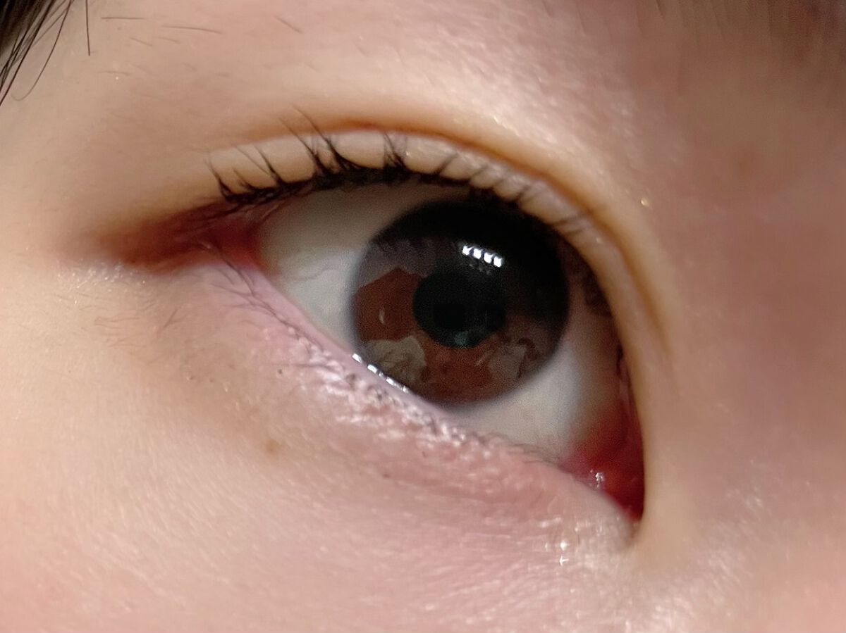 ダブルグルー 接着タイプ/メザイク/二重まぶた用アイテムを使ったクチコミ（3枚目）