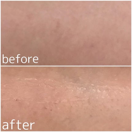 エクソリームローション/NEO COLLECTION/化粧水を使ったクチコミ(6枚目)