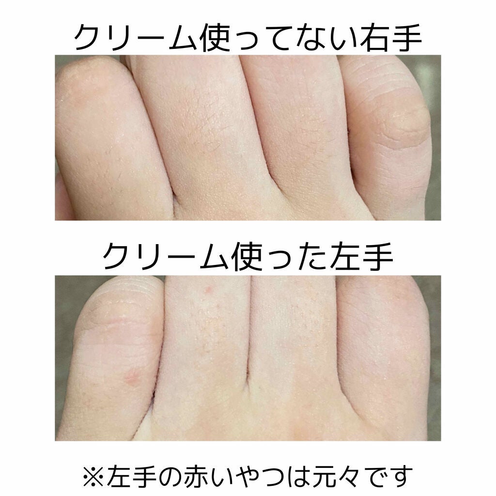 除毛クリーム シトラスホワイトリリィ/スリンキータッチ セルフスパ/除毛クリームを使ったクチコミ(2枚目)