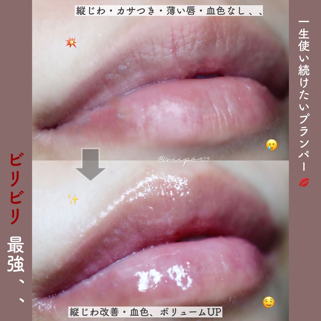 ドトムリッププラスプランパー/keybo/リッププランパーを使ったクチコミ(1枚目)