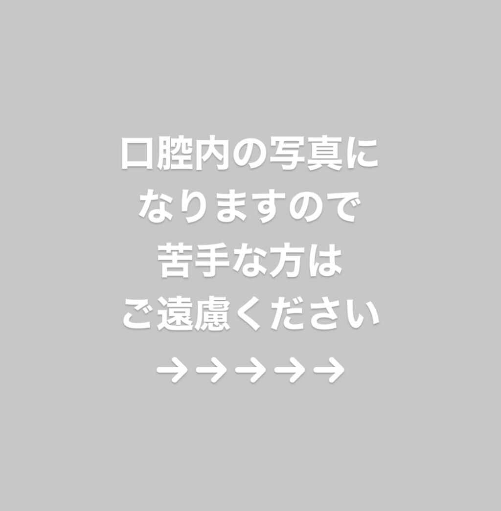 ホワイティエッセンス/MiiS/その他オーラルケアを使ったクチコミ（2枚目）