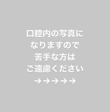 ホワイティエッセンス/MiiS/その他オーラルケアを使ったクチコミ（2枚目）