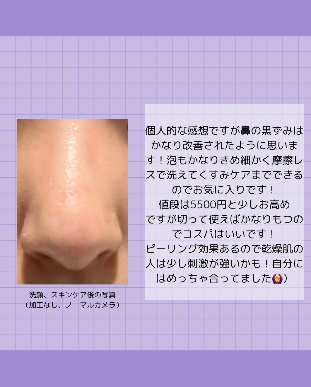 スキンピールバー ハイドロキノール/サンソリット/洗顔石鹸を使ったクチコミ(5枚目)