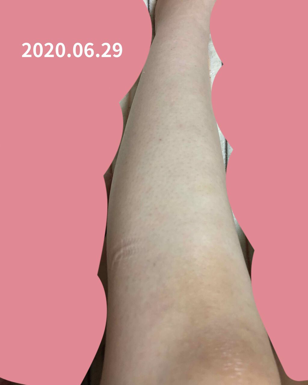 尿素＆ヒアルロン酸全身ローション/アロヴィヴィ/ボディローションを使ったクチコミ（2枚目）