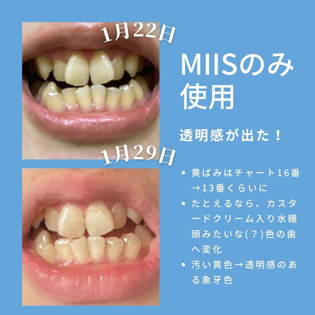 アパガードプレミオ/アパガード/歯磨き粉を使ったクチコミ（2枚目）