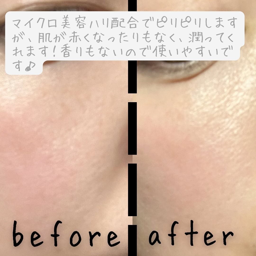 PDRNショット675/COSNORI/美容液を使ったクチコミ(4枚目)