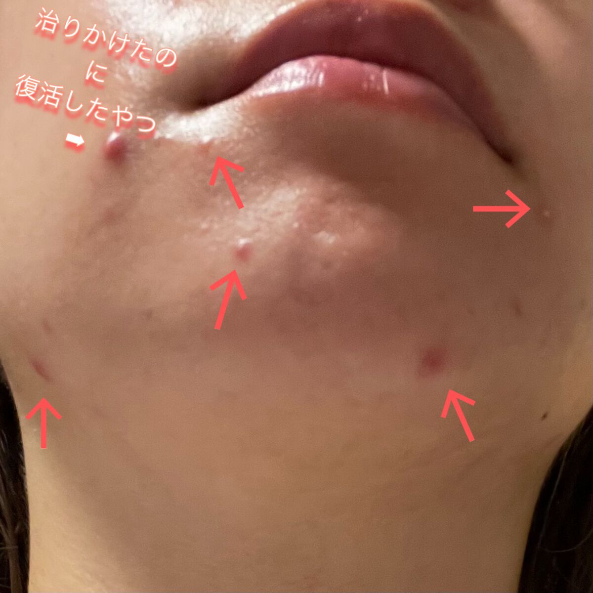 ツボクサ化粧水/ONE THING/化粧水を使ったクチコミ（2枚目）