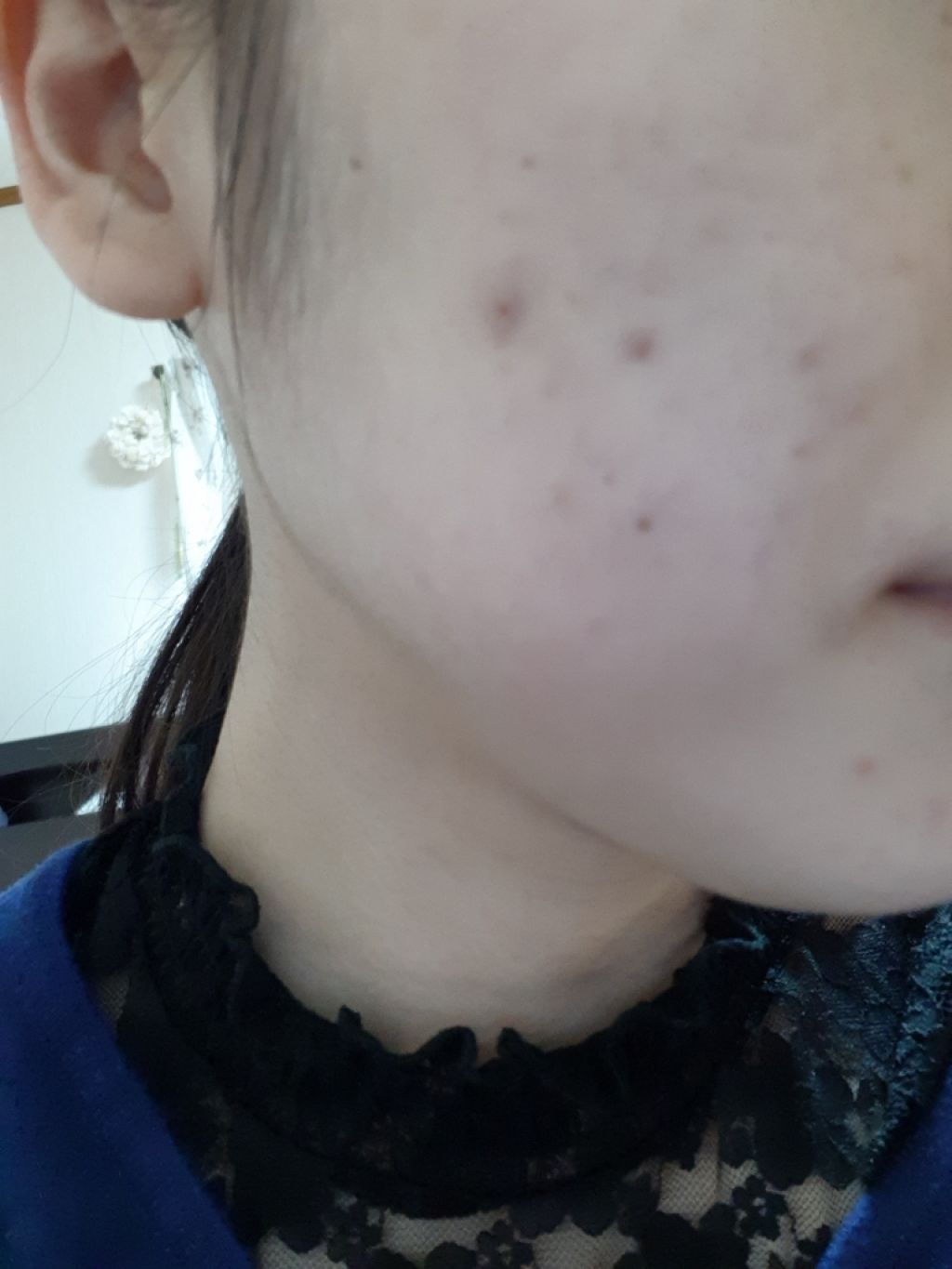 ザ コンシーラー/MISSHA/リキッドコンシーラーを使ったクチコミ(2枚目)