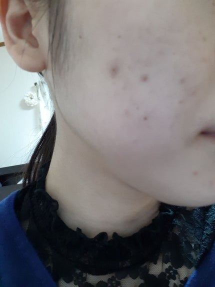 ザ コンシーラー/MISSHA/リキッドコンシーラーを使ったクチコミ(2枚目)