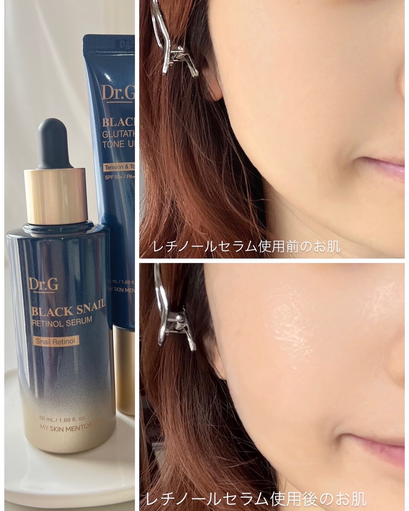ブラックスネイルレチノールセラム/Dr.G/美容液を使ったクチコミ(3枚目)