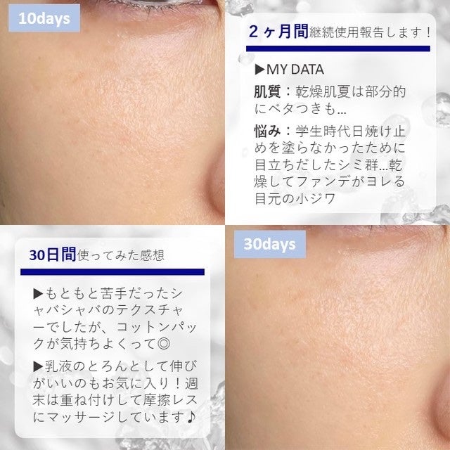 プラチナVCセラム/イデアアクト/美容液を使ったクチコミ(2枚目)