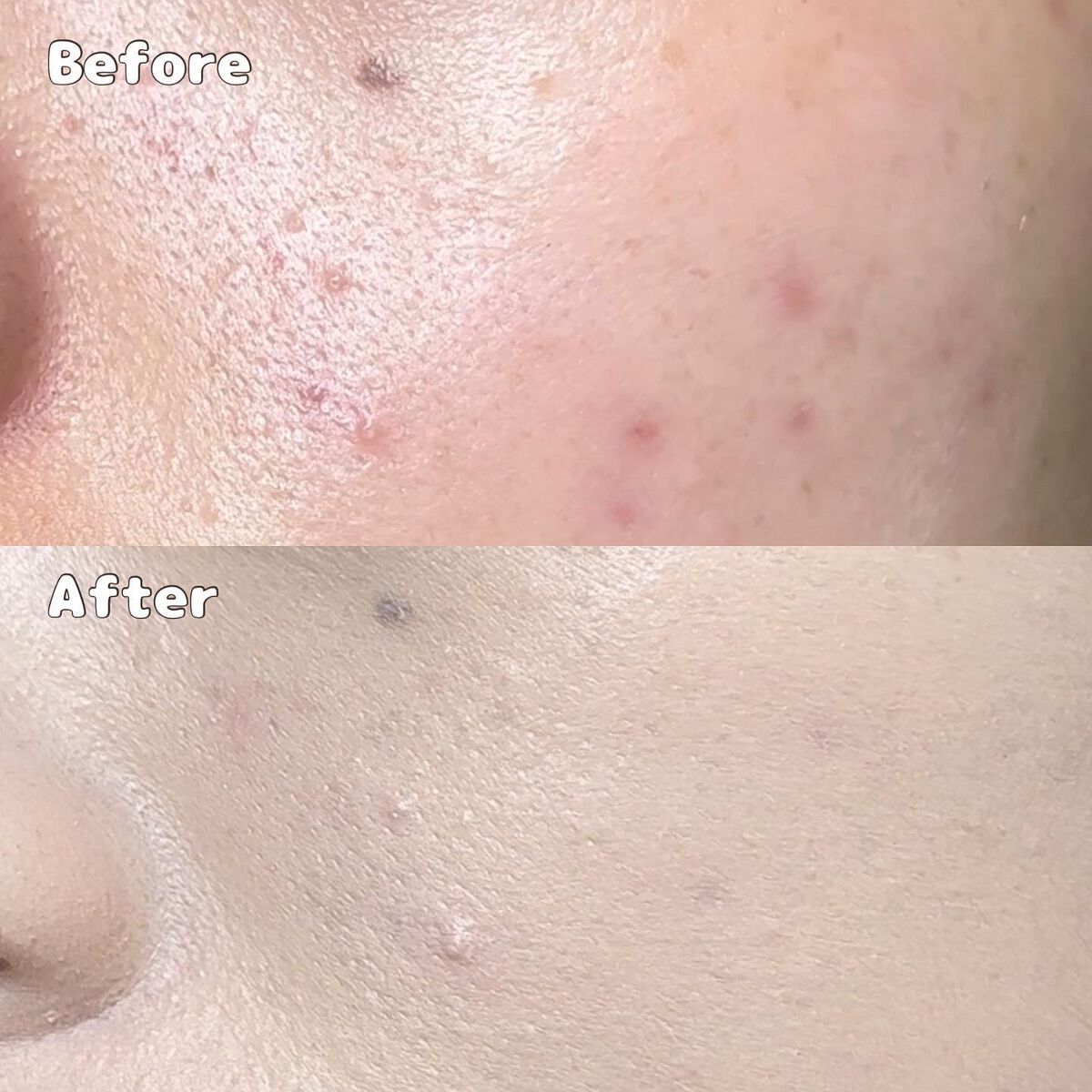 ゼン ウェア フルイド/DECORTÉ/リキッドファンデーションを使ったクチコミ(3枚目)