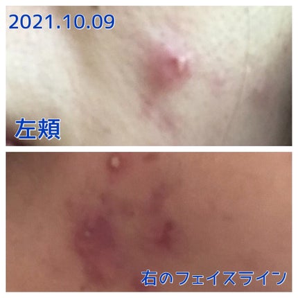 ザ・タイムR アクア/IPSA/化粧水を使ったクチコミ(3枚目)