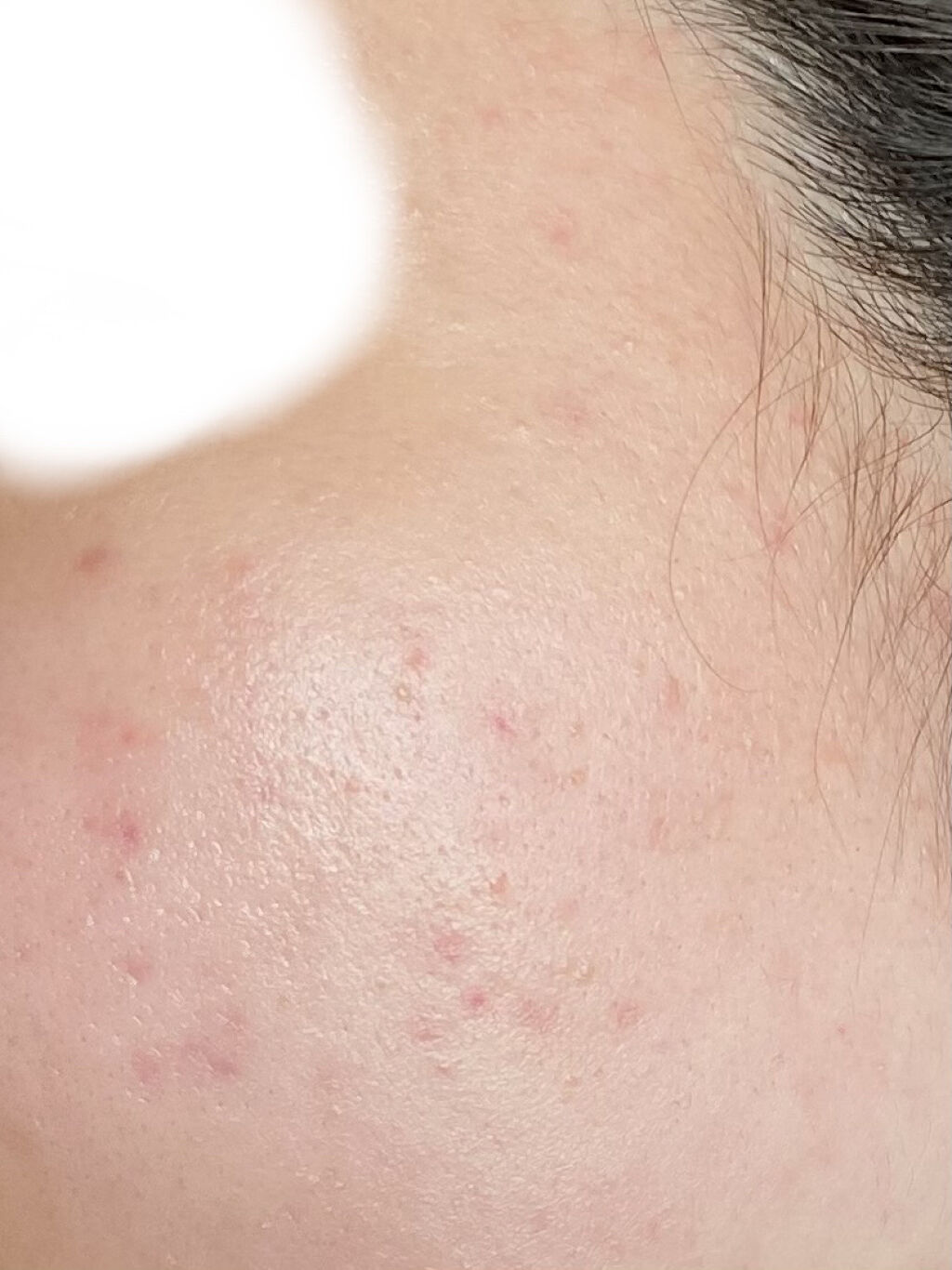 チョコラBBプラス (医薬品)/チョコラBB/その他を使ったクチコミ（3枚目）