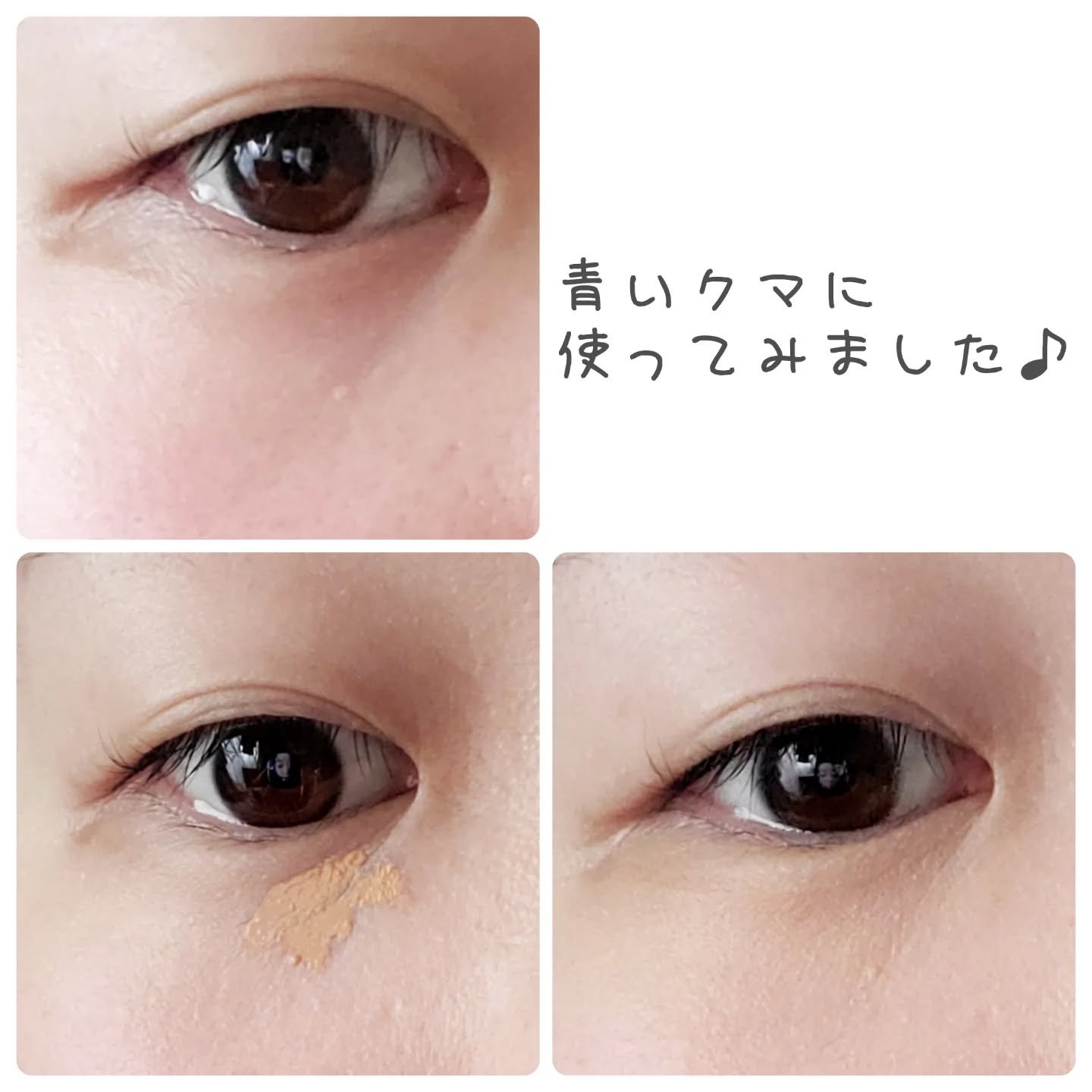 ベアプロ 16HR オールオーバー コンシーラー SPF25（PA+++） ミディアム 300 ニュートラル/bareMinerals/リキッドコンシーラーを使ったクチコミ（3枚目）