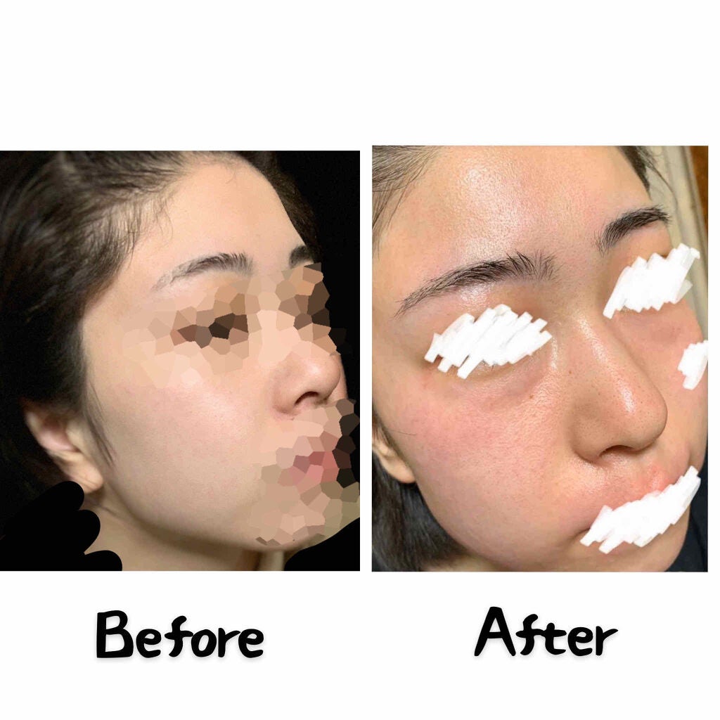 サンホワイトP-1/サンホワイト/ボディクリームを使ったクチコミ(2枚目)