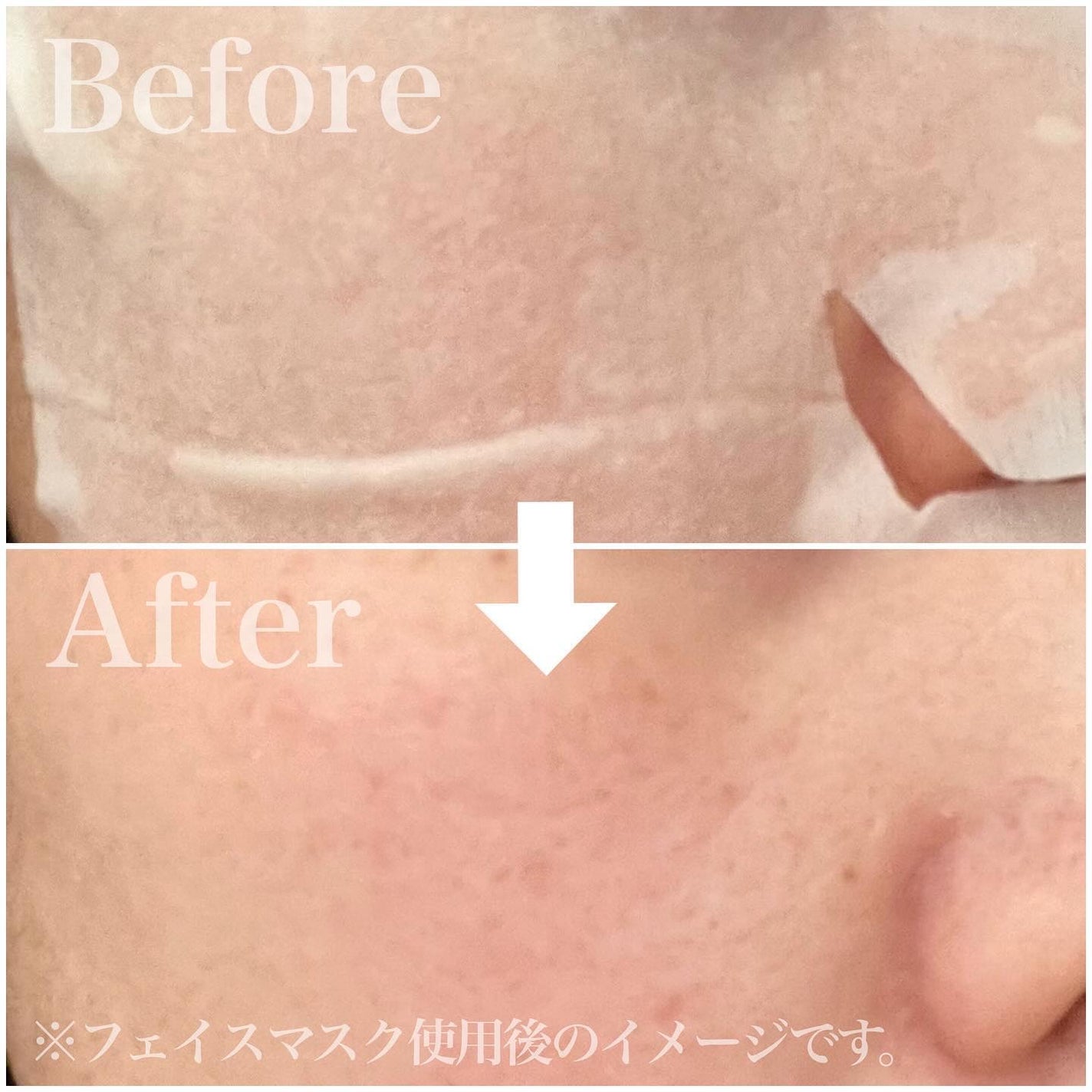 目ざまシート ひきしめタイプ/サボリーノ/シートマスク・パックを使ったクチコミ(7枚目)