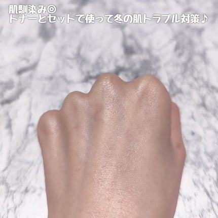 ティーツリーシカスージングトナー/BRING GREEN/化粧水を使ったクチコミ(10枚目)