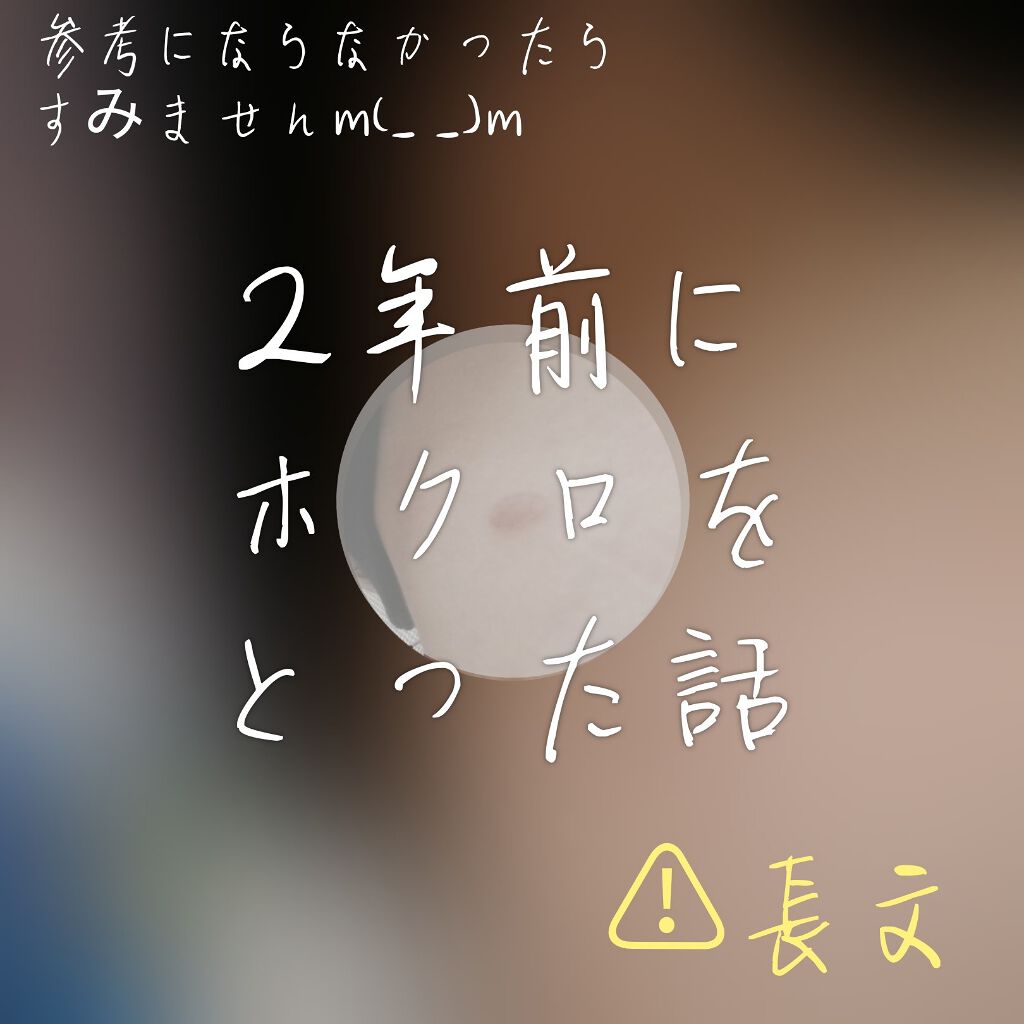 ZeRo(こっそりマイペースに活動中) on LIPS 「⚠長文ですほくろ除去に興味のある方以外はスルーでお願いします・..」(1枚目)