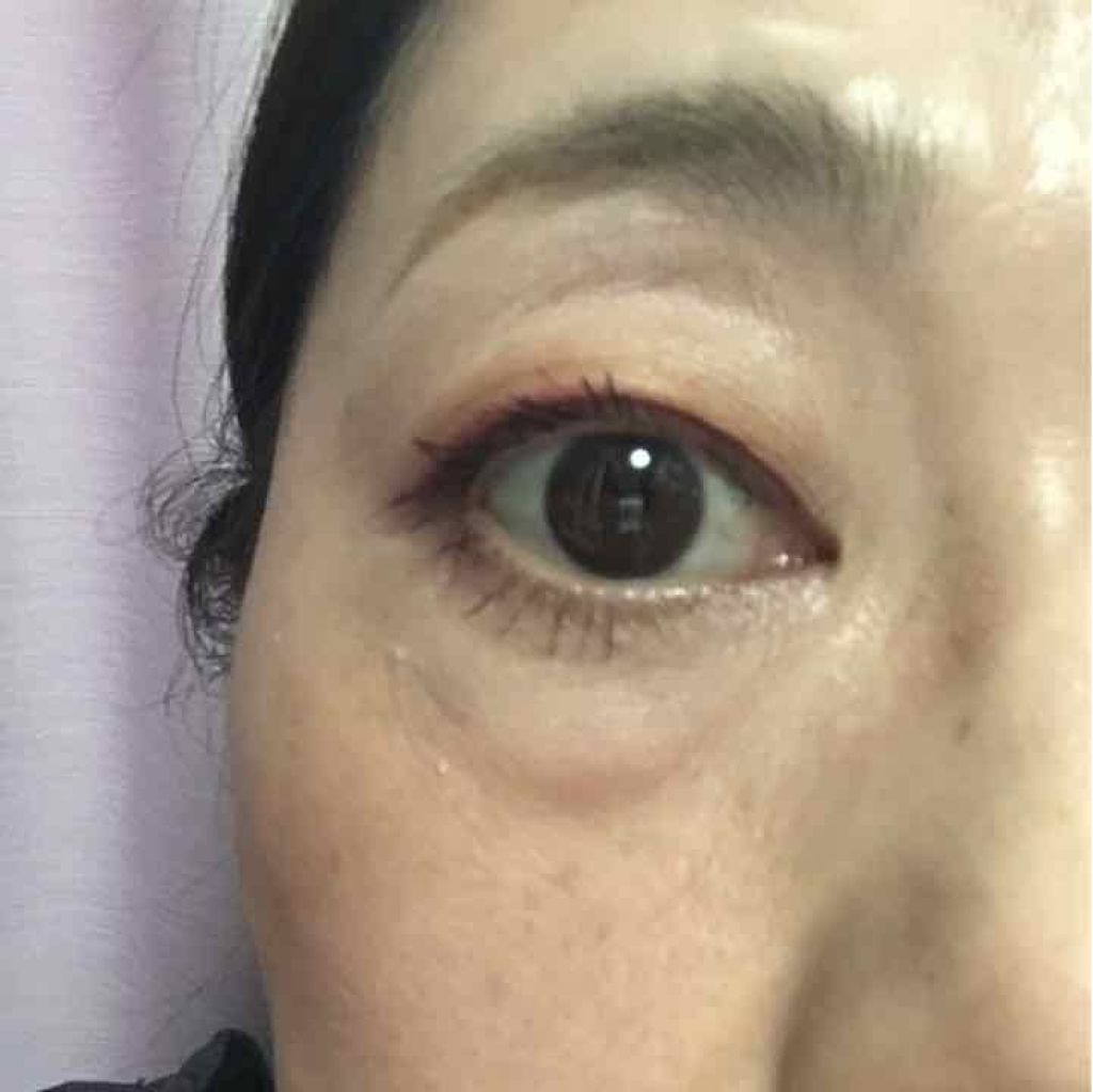 リップグロス N/NARS/リップグロスを使ったクチコミ(1枚目)