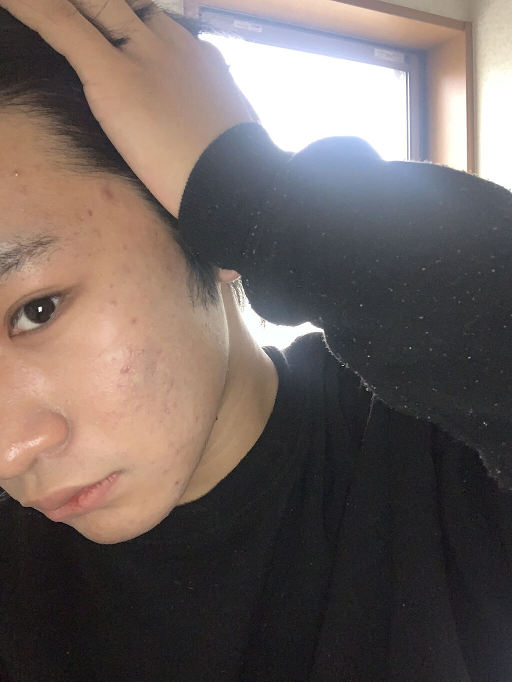 ハトムギ化粧水(ナチュリエ スキンコンディショナー R )/ナチュリエ/化粧水を使ったクチコミ（3枚目）