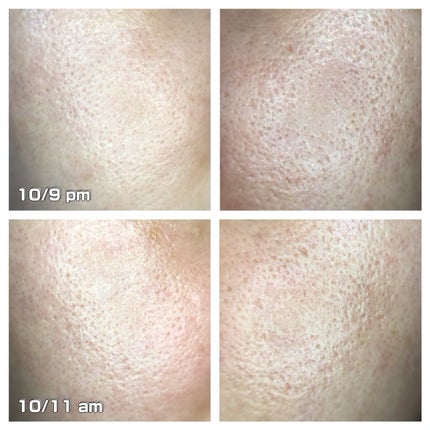 APPS原末/マンデイムーン/その他スキンケアを使ったクチコミ(2枚目)