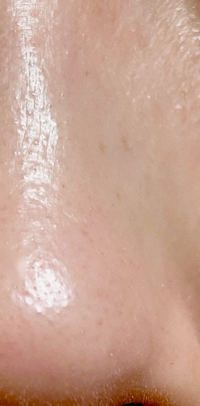 SAD 美株 テンジン 7L ショルダーバッグ - サミットクリエイティブ SUMMIT